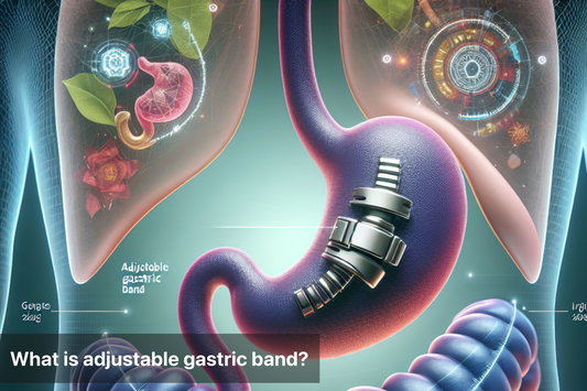 Illustration of an adjustable gastric band in the digestive system