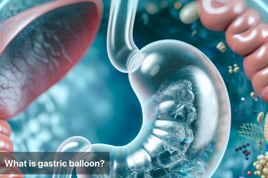 Illustration of a gastric balloon in the stomach for surgical weight loss.
