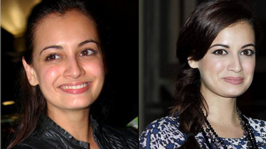 Explore Dia Mirza’s holistic post-pregnancy weight loss journey with yoga, mindful eating, and Elevate Now’s medically guided weight loss solutions.