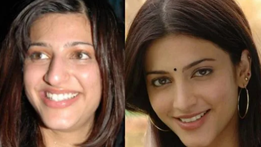 Shruti Haasan’s inspiring weight loss journey—discover her fitness routine, diet plan, and wellness tips. 