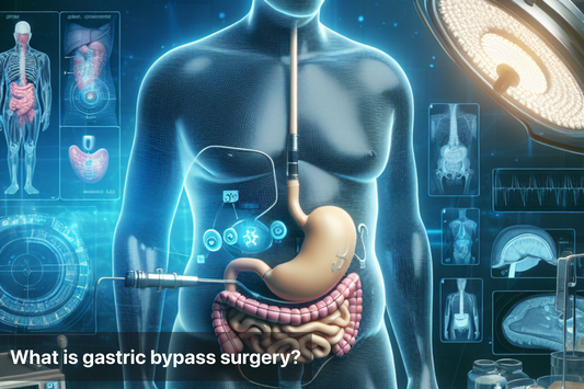 Illustration of the digestive system related to gastric bypass surgery.