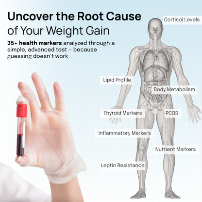 Metabolic Profile for Weight Management - Diabetes